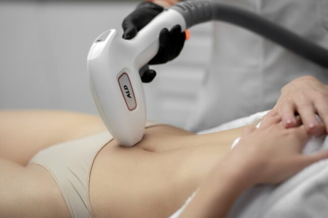 végleges szőrtelenítés, lézeres szőrtelenítés, tartós szőrtelenítés, szőrtelenítési kezelések, bestwax